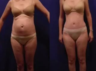 Consigue el cuerpo que deseas