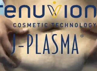 J-Plasma