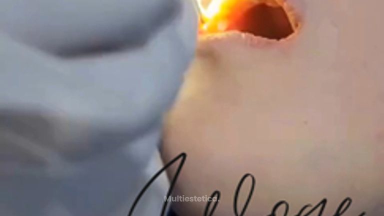 Bichectomia - Dr. Carkis Woge