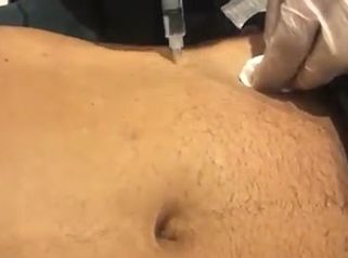 Lipólisis