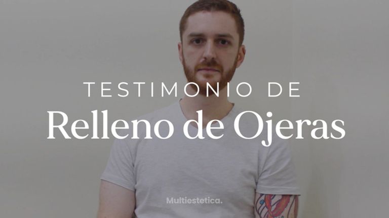 Testimonio de relleno de ojeras - Imagen Art Clinic