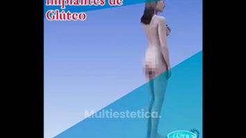 Gluteoplastia - Clínica De Cirugía Plástica Lazer