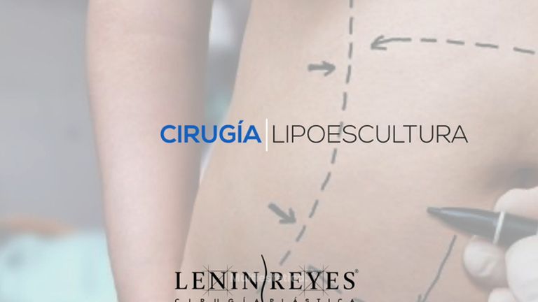 Lipoescultura - Dr. Lenin Alfonso Reyes Ibarra