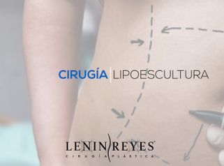 Lipoescultura - Dr. Lenin Alfonso Reyes Ibarra