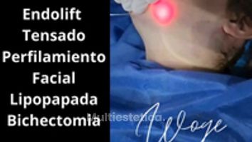 Endolift Perfilamiento Facial - Dr. Carlos Woge