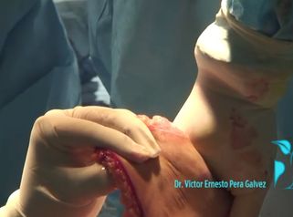 Logra la apariencia ideal de tu abdomen