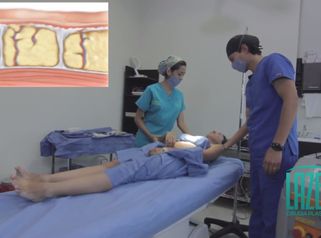 Esculpe tu cuerpo y consigue la forma deseada