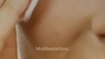 HIFU - Moskalia
