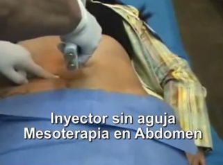 Mejora el aspecto de tu cuerpo