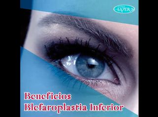 Blefaroplastia - Clínica De Cirugía Plástica Lazer