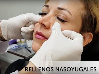 3ra Parte RELLENO NASOYUGAL - Rejuvenecimiento Facial no Quirúrgico 