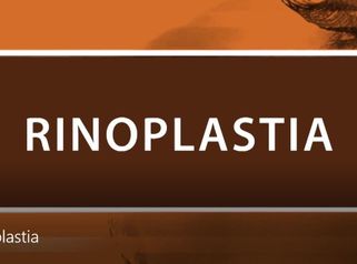 Rinoplastia