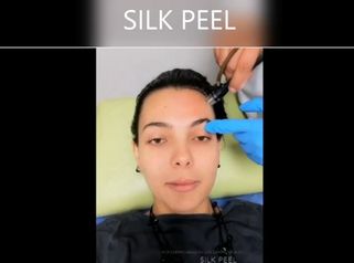 Silk Peel - Dr. Mario Alonso Flores Saldivar