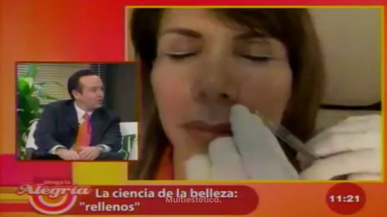 Rellena tu piel y luce más bonita