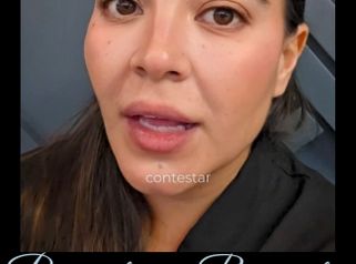 Armonizacion Facial - Dra. Lorena Piña