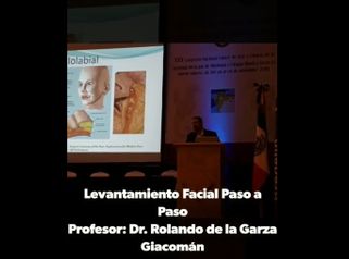 Lifting - Fasent. Dr Rolando de la Garza Giacomán