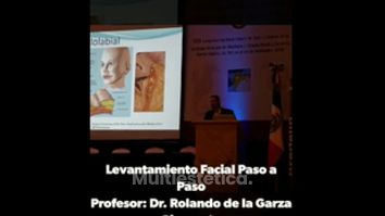 Lifting - Fasent. Dr Rolando de la Garza Giacomán