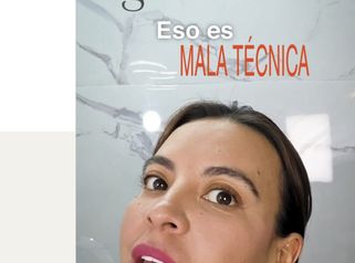 Botox - Dra. Lorena Piña