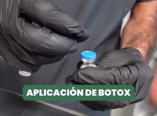 Aplicación Toxina Botulínica - CRE