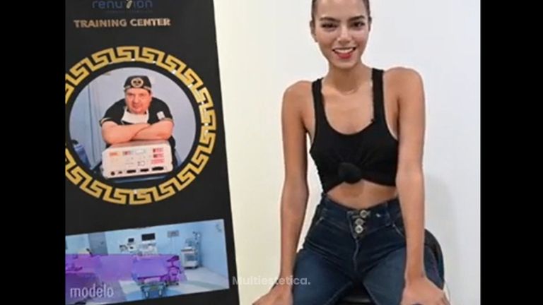 Testimonio actriz y modelo Sofia Sanz. Rinoplastia