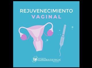 Rejuvenecimiento Vaginal - Centros Euroestetica Toluca