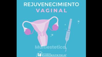 Rejuvenecimiento Vaginal - Centros Euroestetica Toluca