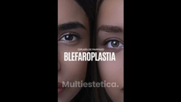 Blefaroplastia - Dr. Gerardo Rayón Nieva