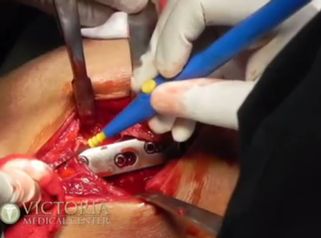 Las mejores soluciones de traumatología