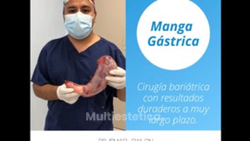 Manga Gástrica - Dr. Ismael Bailon