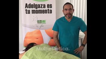 Carboxiterapia