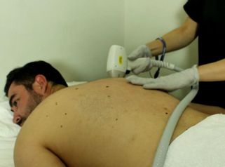 Depilación