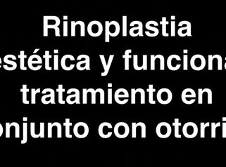 RINOPLASTIA ESTETICA Y FUNCIONAL