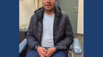 Testimonio Otoplastia - Dr. Sergio Guillermo Ramírez Ledesma