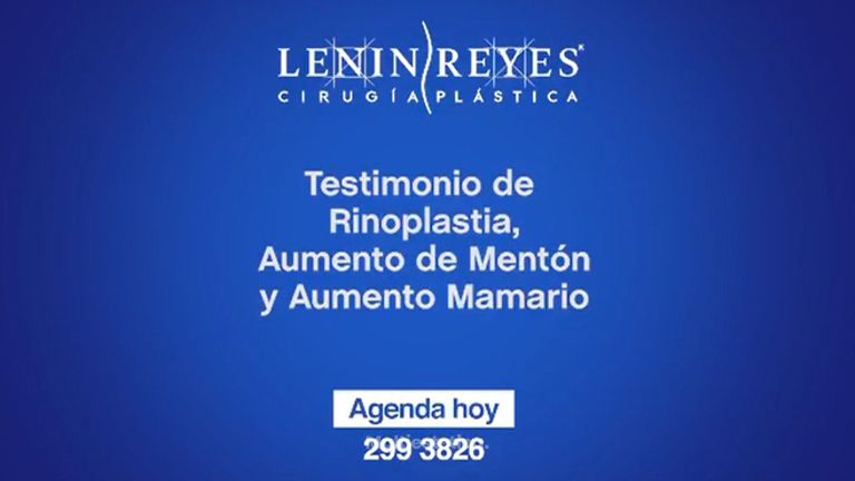 Testimonio de Rinoplastia, Aumento de Mentón y Aumento Mamario