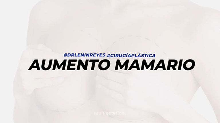 Aumento mamario