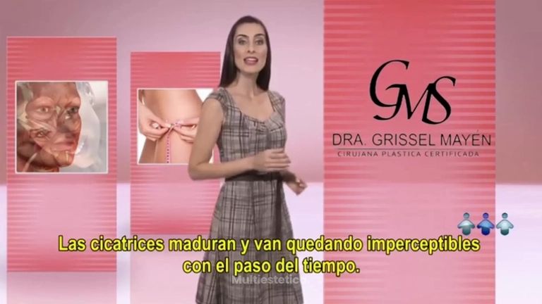 Rinoplastia (Cirugia de la nariz) - Dra Grissel Mayen