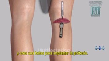 Consigue unas piernas bonitas