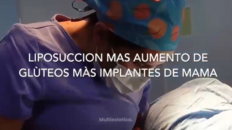 Gluteoplastia - Dr. Sigfrido García Román