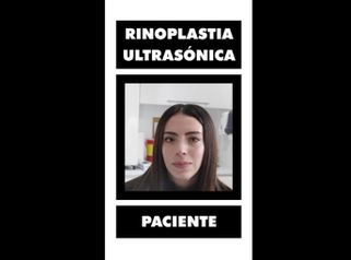 Rinoplastia - Dr. Lenin Alfonso Reyes Ibarra