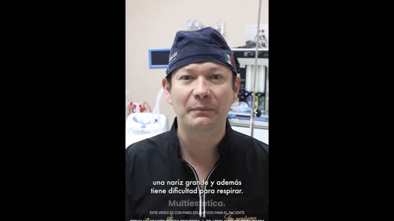 Rinoplastia - Dr. Lenin Alfonso Reyes Ibarra