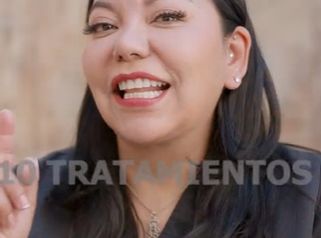 Tratamientos con toxina botulínica - MEILi Rejuvenecimiento