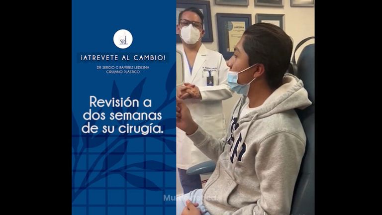 Rinoplastia - Dr Sergio Guillermo Ramírez Ledesma
