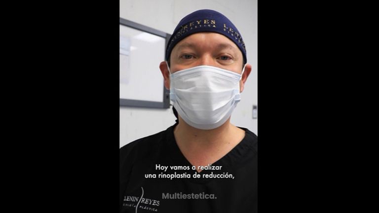 Rinoplastia - Dr. Lenin Alfonso Reyes Ibarra