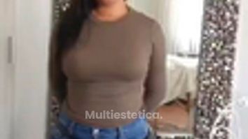Abdominoplastia - Clinica Meili