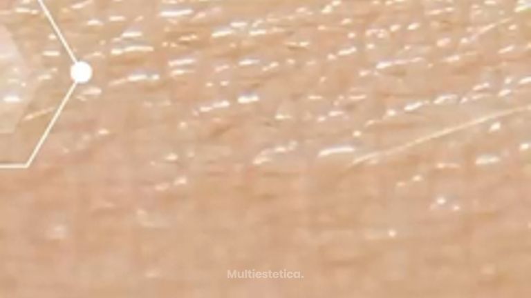 Rejuvenecimiento Facial - CMCells