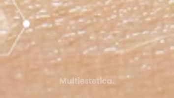 Rejuvenecimiento Facial - CMCells