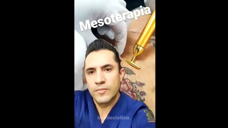 Mesoterapia - Dr. Raúl Sierra Franco