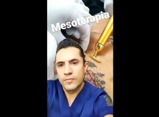 Mesoterapia - Dr. Raúl Sierra Franco