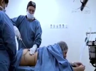 Elimina la grasa sobrante de tu cuerpo