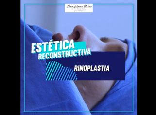 Dr. Jhon Gómez Cirujano Plástico - Rinoplastia